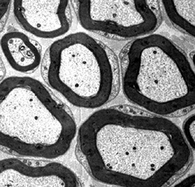 Electron microscope image of a peripheral nerve bundle containing several axons. The black rings are the myelin sheaths